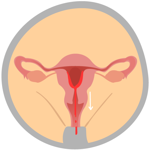 Menstruation