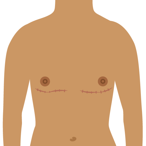 At skifte køn (transitionere)